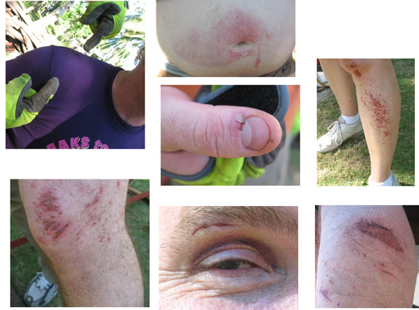 scaps-and-bumps.jpg